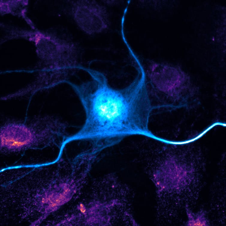 neuroscience7