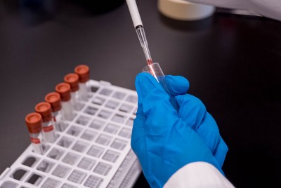 Μελέτη-ορόσημο εντόπισε 102 γονίδια σχετικά με τον αυτισμό